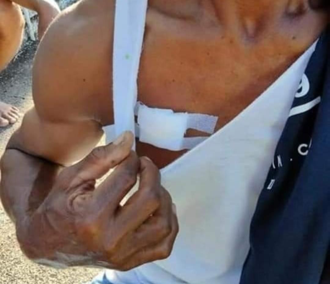 laki-laki alami luka tembak di dada pada tragedi anggota Brimob tembak warga sipil di Maluku Tengah