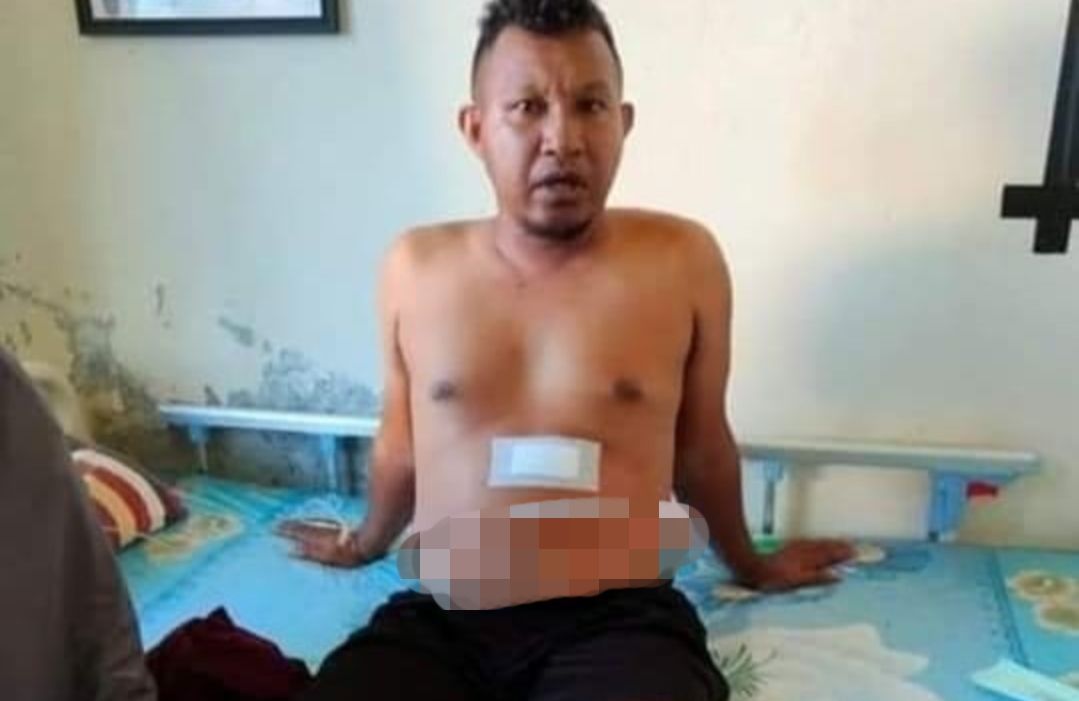 laki-laki korban penembakan di Maluku Tengah, diduga oknum anggota Brimob