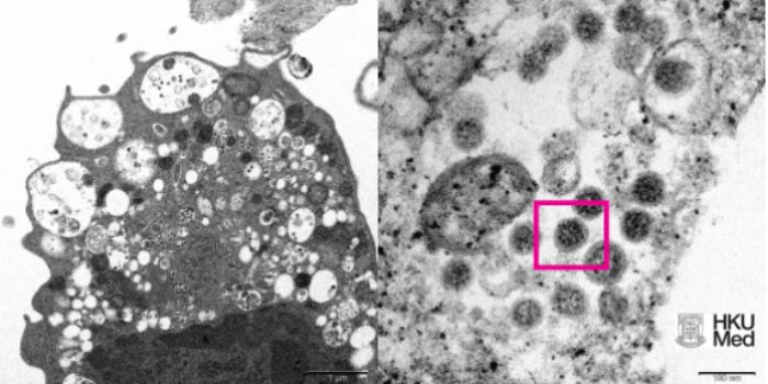  Gambar virus Corona varian Omicron yang diambil menggunakan mikroskop oleh para peneliti Universitas Hongkong. Gambar itu dipublikasi pada Rabu, 8 September 2021 waktu setempat.