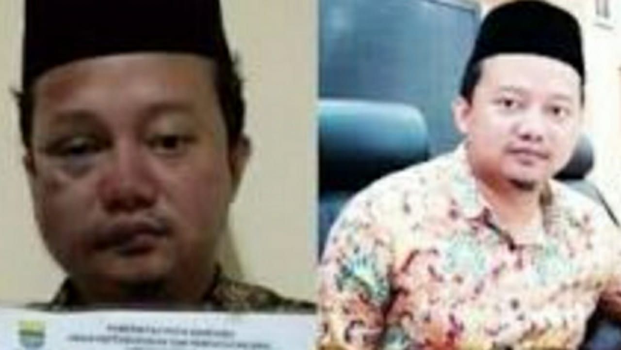 Beredar viral di TikTok, Twitter dan facebook, foto-foto 'penjahat kelamin' Herry Wirawan babak belur, diisukan dikeroyok tahanan lain di penjara Rutan 1 Bandung.