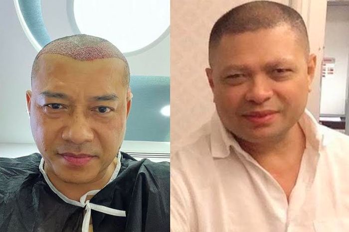 Viral di TikTok dan Instagram! Wajah baru Anang Hermansyah, kepala botak, kini parasnya disebut sangat mirip Raul Lemos, suami Krisdayanti