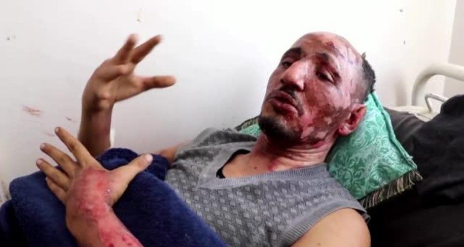 Kesaksian Korban Perang Timur Tengah di Yaman dalam Serangan Koalisi Arab Saudi: Saya Menangis Minta Tolong. /Tangkapan Layar Video Reuters