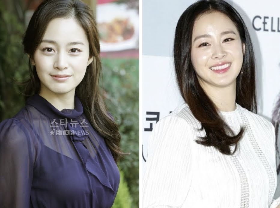 Actress Kim Tae Hee in 2000’s (left) and current (right) | Star News, Yonhap News