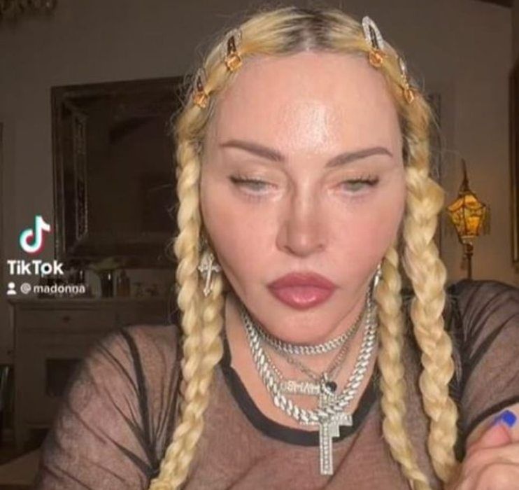 Wajah Madonna makin aneh, penggemar bingung dan khawatir.//Olah foto kolase tangkap layar TikTok Madonna DailyMail