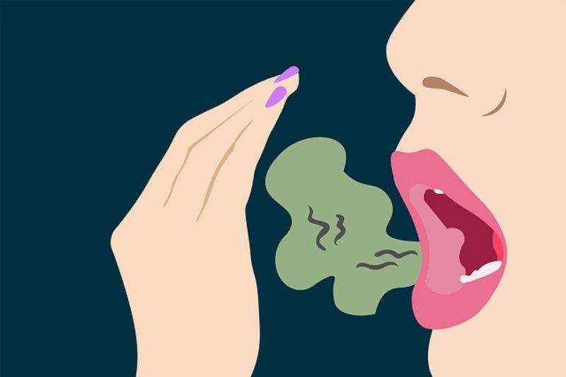 Ilustrasi bau mulut, lantas Apa Penyebab Bau Mulut? Lantas Bagaimana Cara menghilangkan Bau Mulut Yang Benar Menurut Medis? Berikut Ulasannya