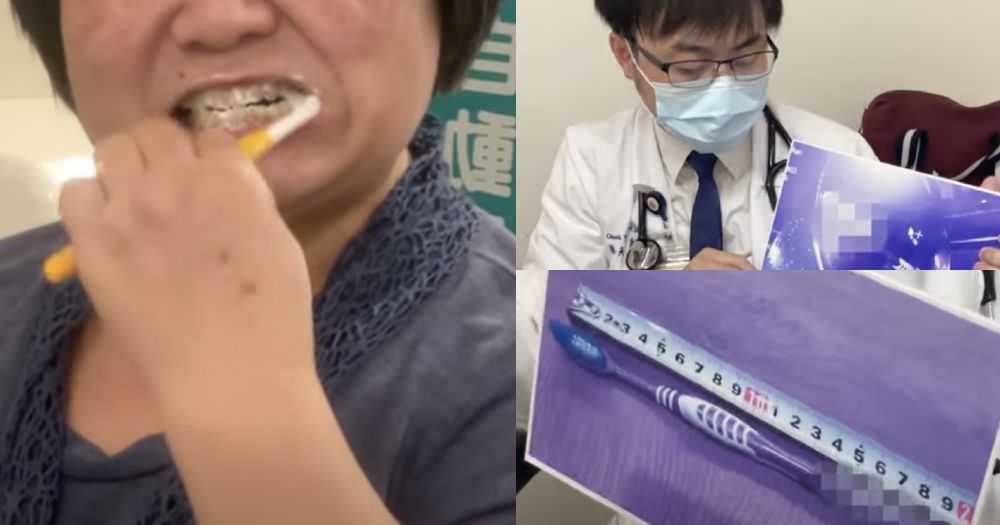 Wanita Taiwan Ngaku Telan Sikat Gigi Berukuran 18 cm, Baru Periksa Selang 7 Jam Setelah Pulang Kerja