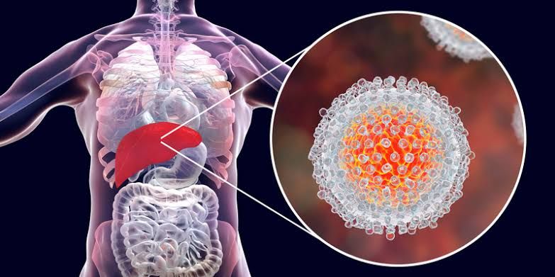 Benarkah Hepatitis Meningkatkan Risiko Gagal Hati? Berikut Gejala dan Penyebab yang Harus Diwaspadai