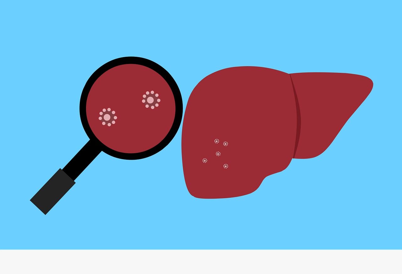 Ilustrasi hepatitis Akut misterius/Pixabay/Mohamed Hassan