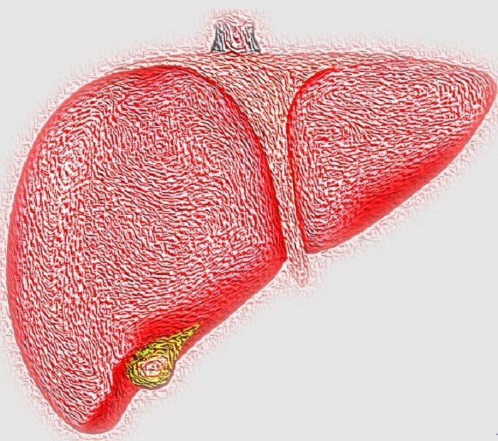 hepatitis akut menyebab kerusakan permanen pada hati penderita./pikiran-rakyat.com