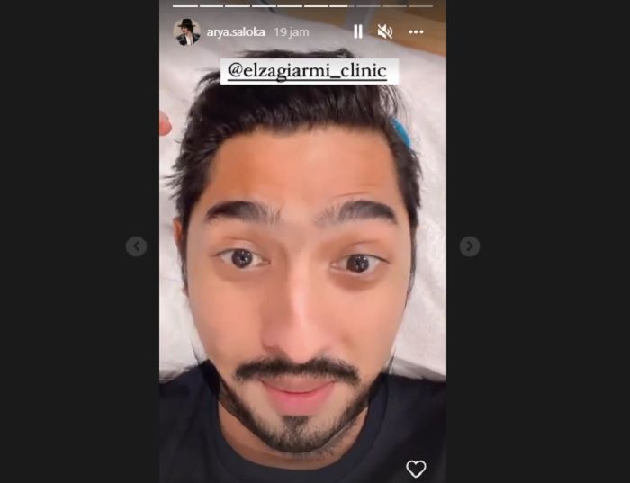 Unggahan story Instagram @arya.saloka yang menunjukkan pemeran Aldebaran itu sedang melakukan perawatan wajah.