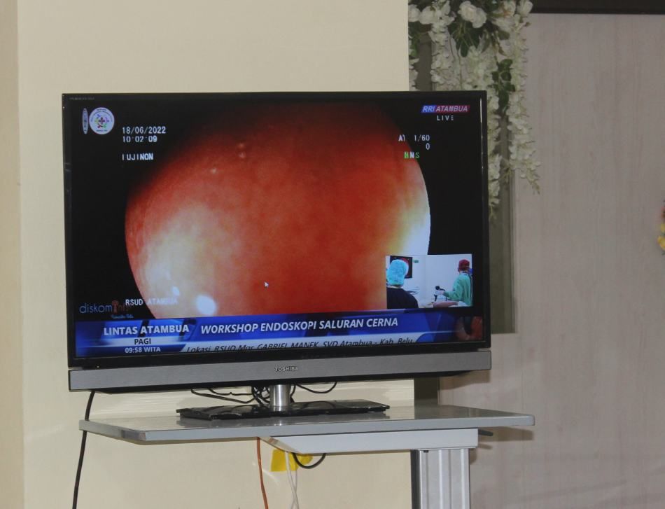 Hasil pemeriksaan endoskopi terhadap salah satu pasien di RSUD Atambua saat grand opening