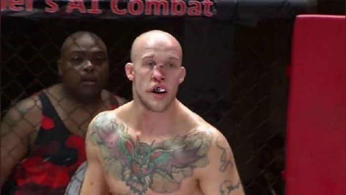 Petarung UFC Blake Perry mengalami cedera hidung yang cukup parah.*  
