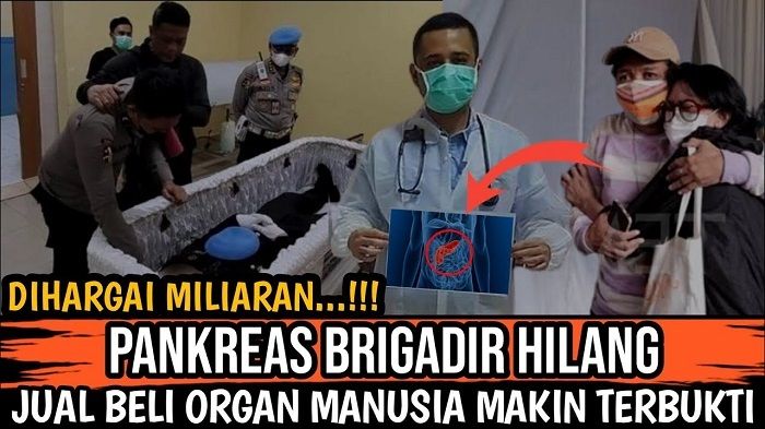 Konten hoaks yang menyebut pankreas Brigadir J dihargai miliaran dan telah terjadi jual beli organ manusia