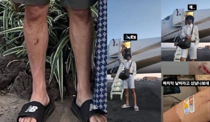 Foto luka pada kaki V BTS. Diduga persis dengan foto yang tersebar dengan Jennie BLACKPINK. Kolase Telegram