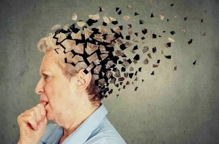 Ilustrasi penyintas Alzheimer. 