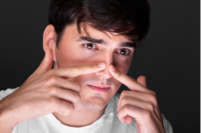5 tips merawat kulit yang berminyak agar terhindar dari berbagai masalah yang kerap terjadi di wajah
