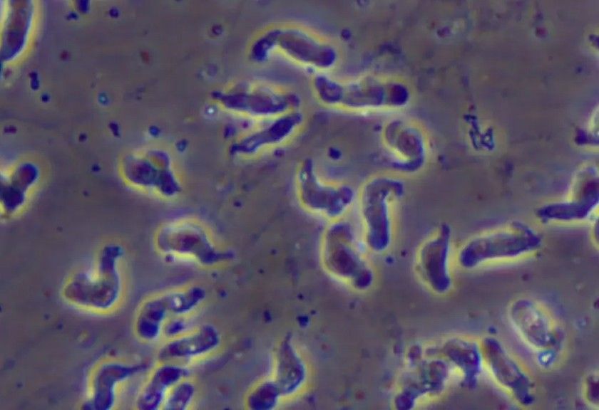 Apa Itu Naegleria Fowleri? Amoeba Pemakan Otak Yang Tewaskan Pria Di ...