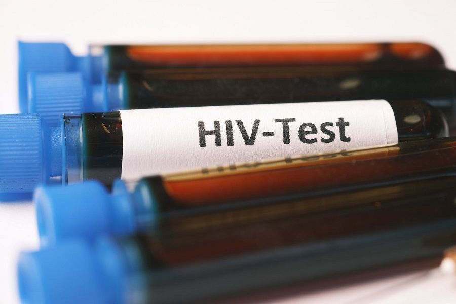 Ilustrasi kasus dan penanganan HIV AIDS./Pixabay/