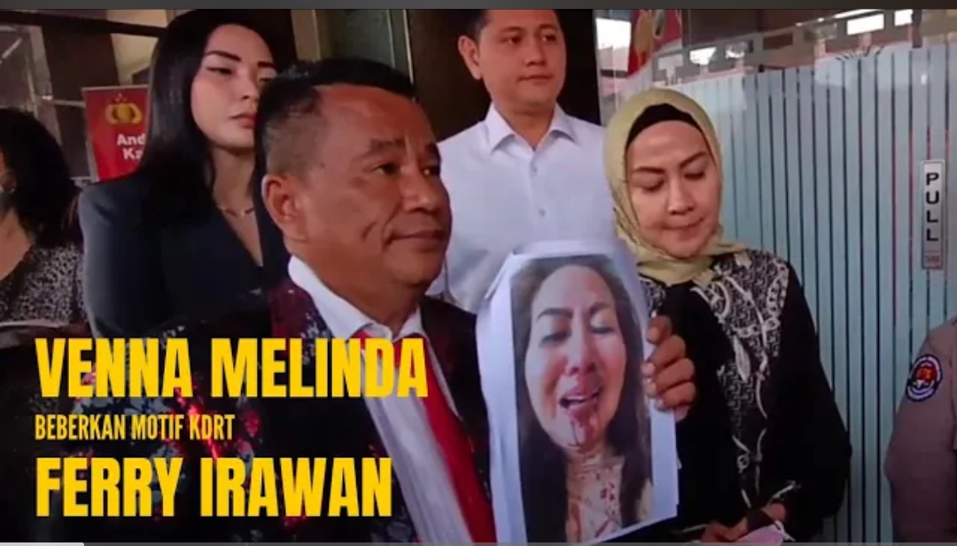 Sadis! Ternyata Bukan Yang Pertama, Venna Melinda Sudah 3 Bulan Alami KDRT Oleh Ferry Irawan