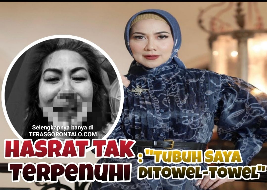 MIRIS! Venna Melinda Bongkar Kebusukan Ferry Irawan, Hasrat Tak Terpenuhi Malah KDRT: Organ Tubuh Saya di Towel-Towel