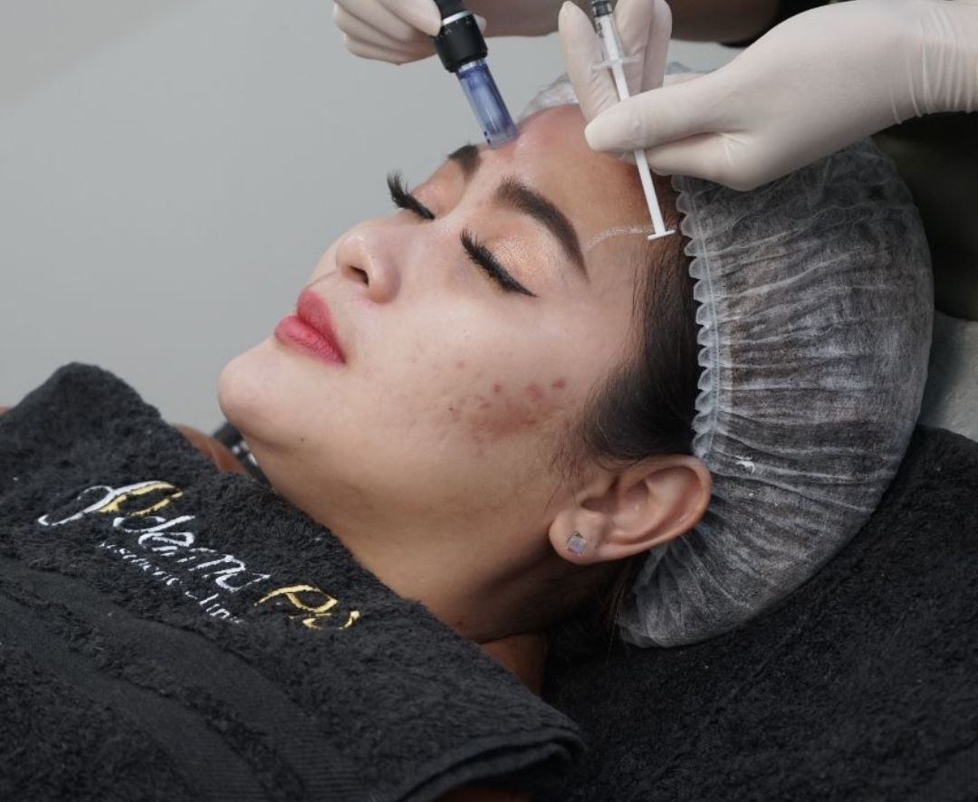 Rajin Treatment di Klinik Mahal, Vega Darwanti: Merawat Kecantikan Wajah adalah Investasi