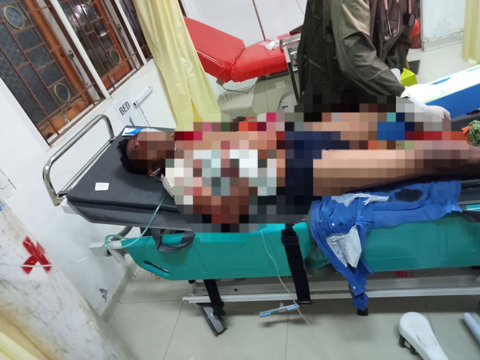 Korban penganiayaan di Kelurahan Anggoeya, dirawat intensif di Rumah Sakit, setelah terkena sabetan parang saat miras bersama temannya.