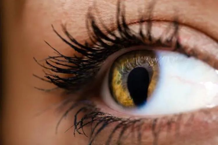 Bentuk koloboma yang paling umum adalah yang mempengaruhi iris mata. Seringkali membuat penderitanya memiliki pupil yang berbentuk seperti lubang kunci.