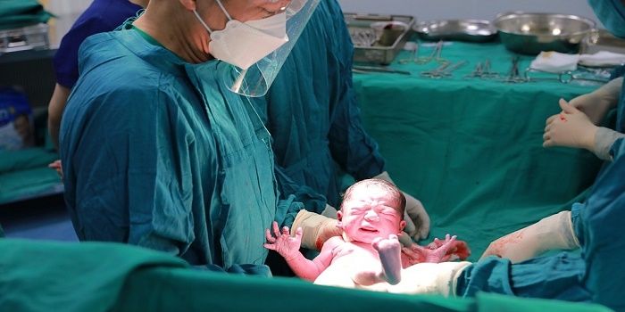 Berapa kali operasi caesar boleh dilakukan, yuk cari tahu moms. Hasil riset menyatakan operasi caesar kian berisiko manakala dilakukan berulang-ulang. (Foto ilustrasi: Pixabay/BabyMin)