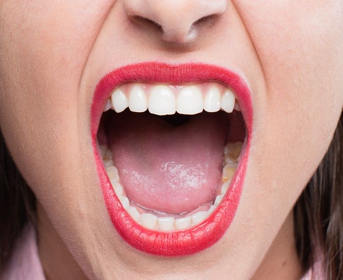 Ilustrasi Cara Menjaga Bau Mulut saat berpuasa.