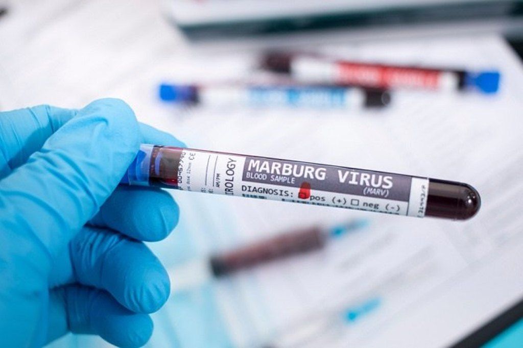 Waspada Virus Marburg