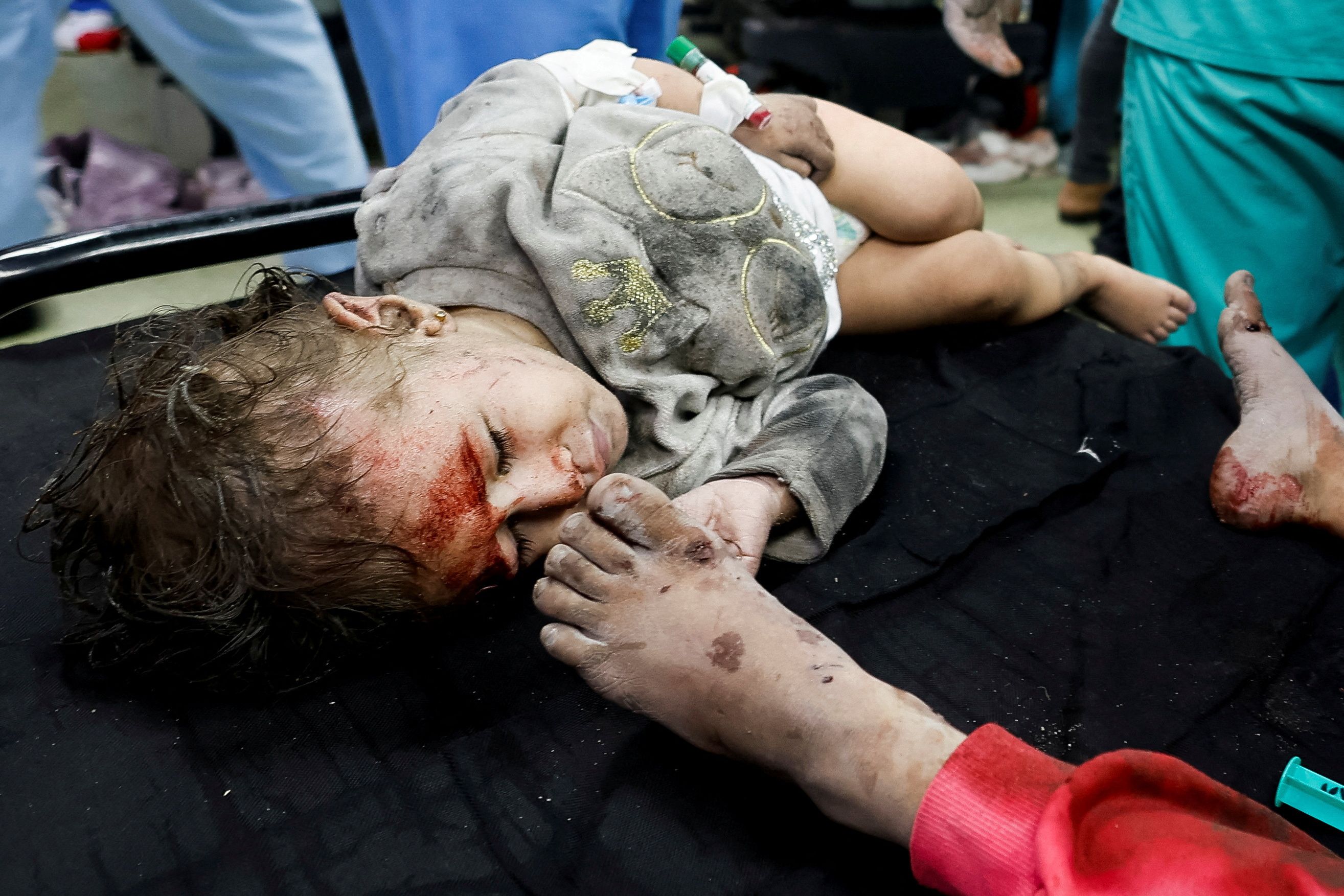 Seorang anak Palestina yang terluka dalam serangan Israel dibantu di rumah sakit Nasser, di tengah konflik yang sedang berlangsung antara Israel dan kelompok Islam Palestina Hamas, di Khan Younis di selatan Jalur Gaza 18 November 2023.