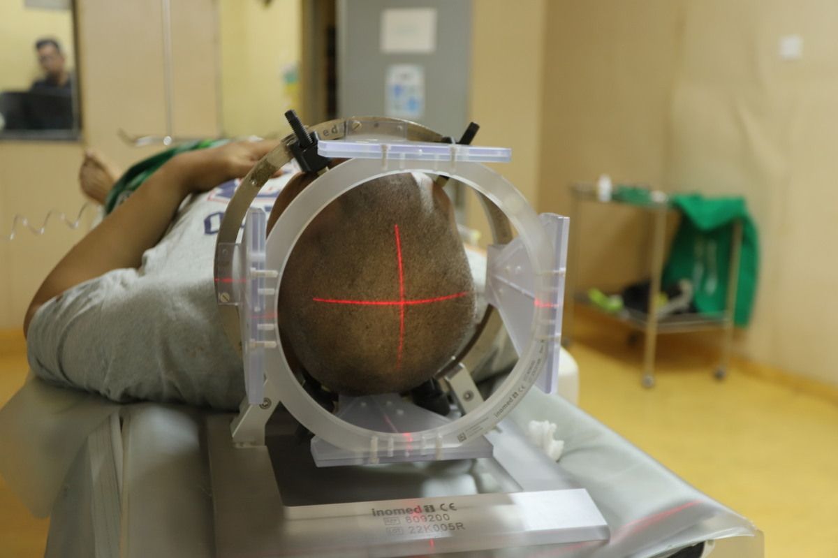 Operasi stereotaktik tumor biopsi pada pasien tumor otak