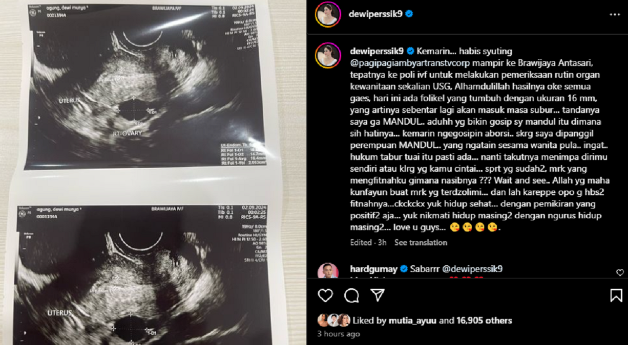 Dewi Perssik buktikan bahwa dirinya tidak mandul./Instagram @dewiperssik9