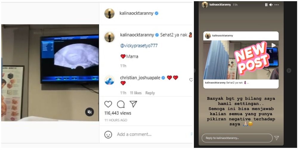 Kalina Okctaranny membagikan video yang menunjukkan dirinya tengah memeriksakan kandungannya usai dituding hamil settingan.*