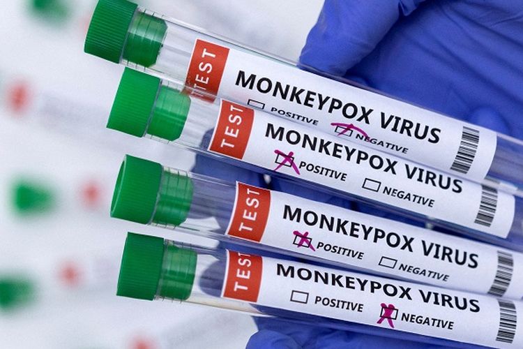 Beware of monkeypox, know how to avert and indicators