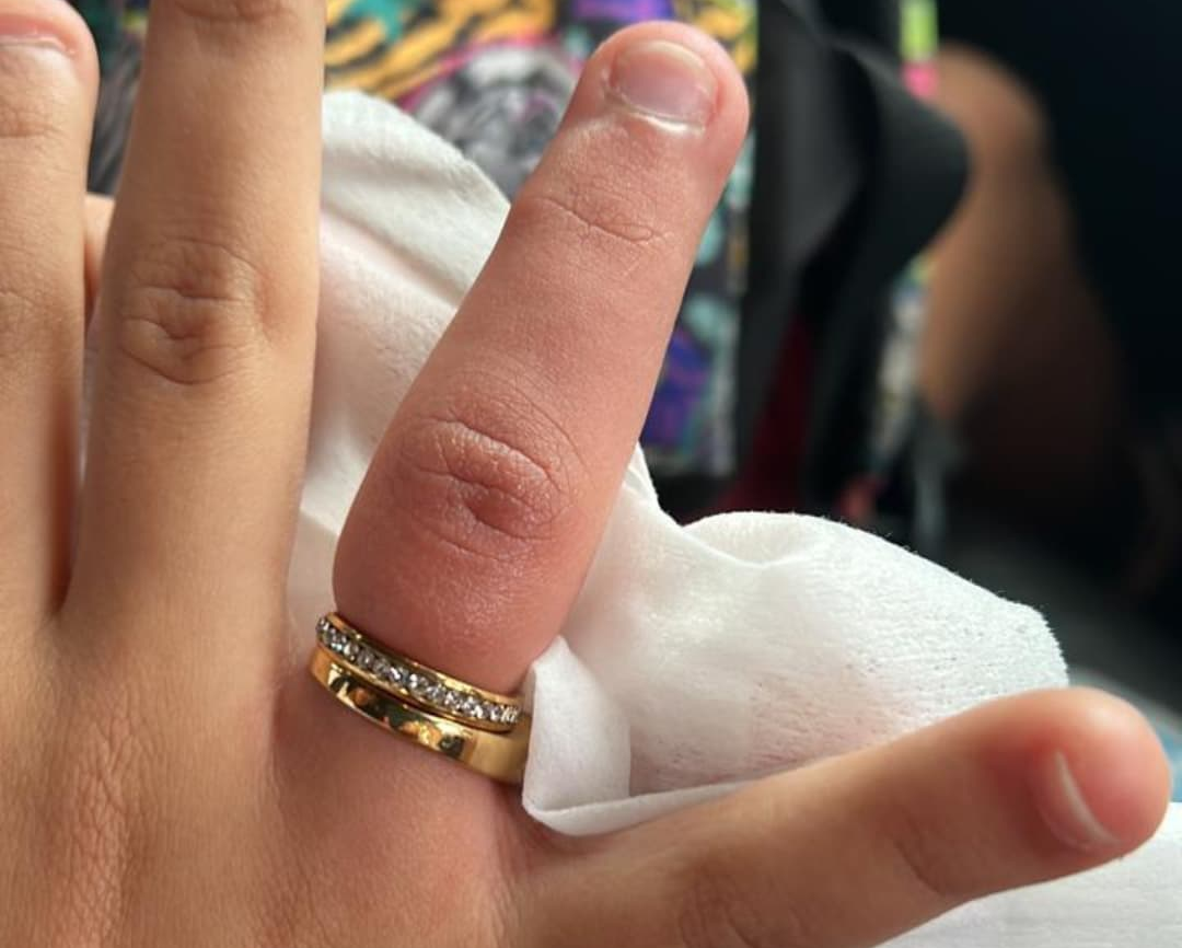Salah satu anggota keluarga Luizinho Passos mengalami musibah cincin nyangkut di jari.