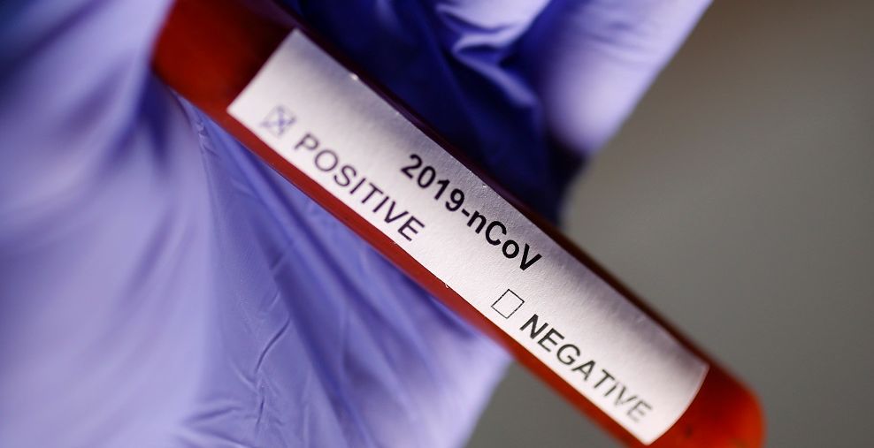 TABUNG tes berisi sampel darah positif mengandung virus corona, 29 Januari 2020.*