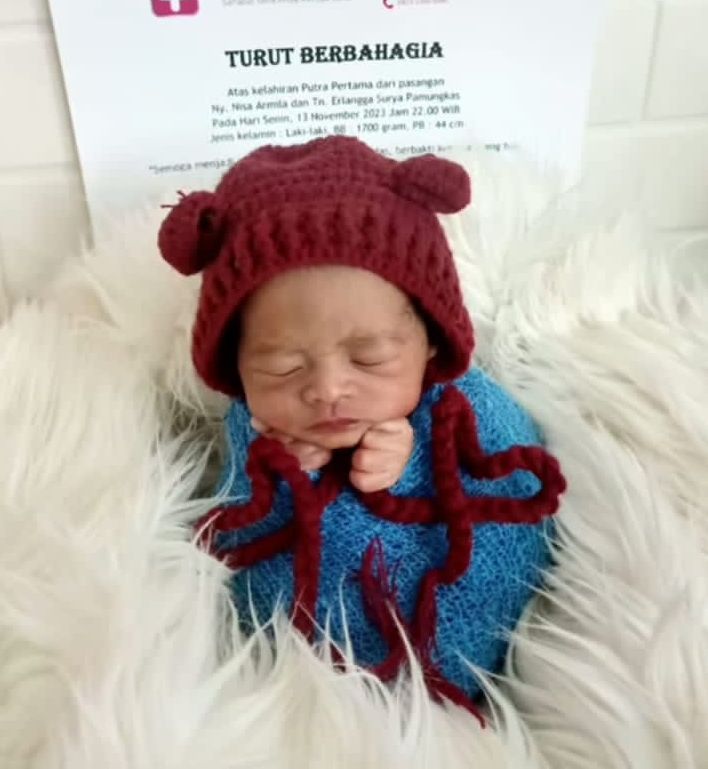 Bayi prematur meninggal di Tasikmalaya setelah jalani pemotretan newborn