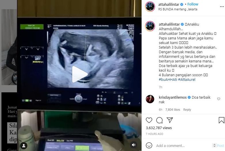 Rahasiakan Kehamilan Aurel Selama 3 Bulan dari Media, Atta Halilintar: 4 Bulanan Pengajian Sooon