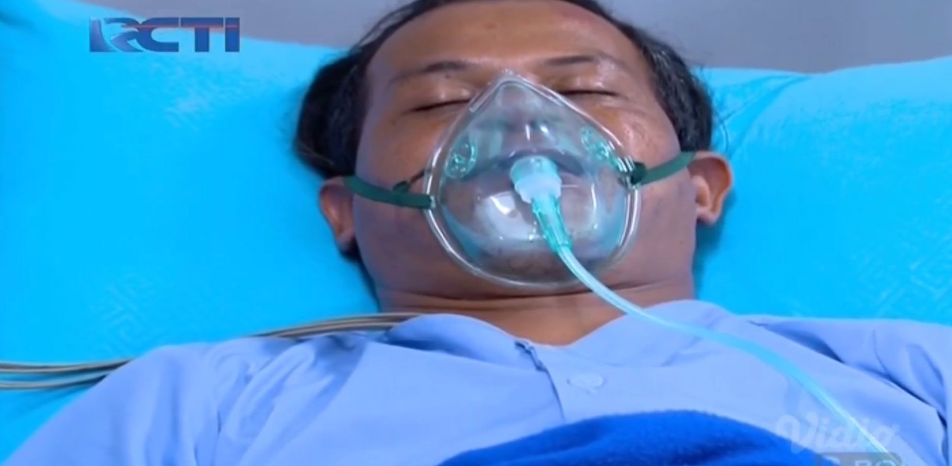 Kondisi Sumarno di Rumah sakit.