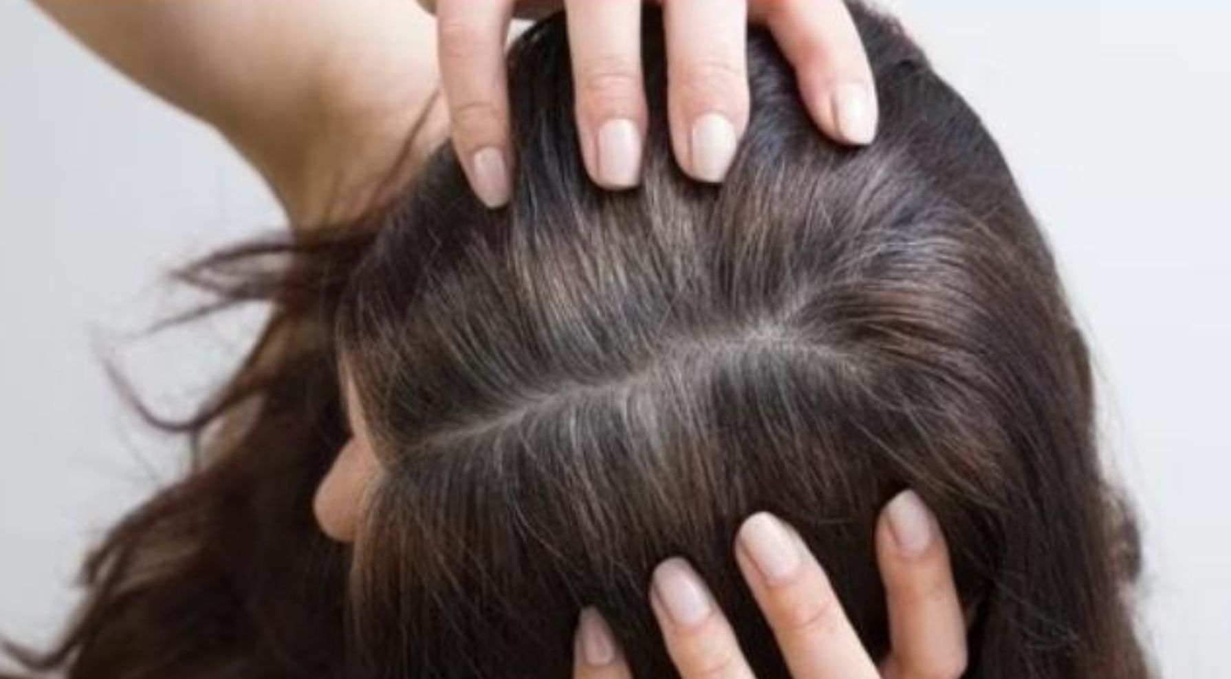 Simak! Rambut Berminyak Dan Lepek, Berikut Tips Dan Cara Mengatasi ...