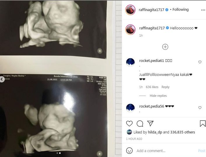 Nagita Slavina Unggah Foto USG Anak Keduanya, Banyak Netizen Memberi Sebutan dengan Nama 'Adik Sultan'