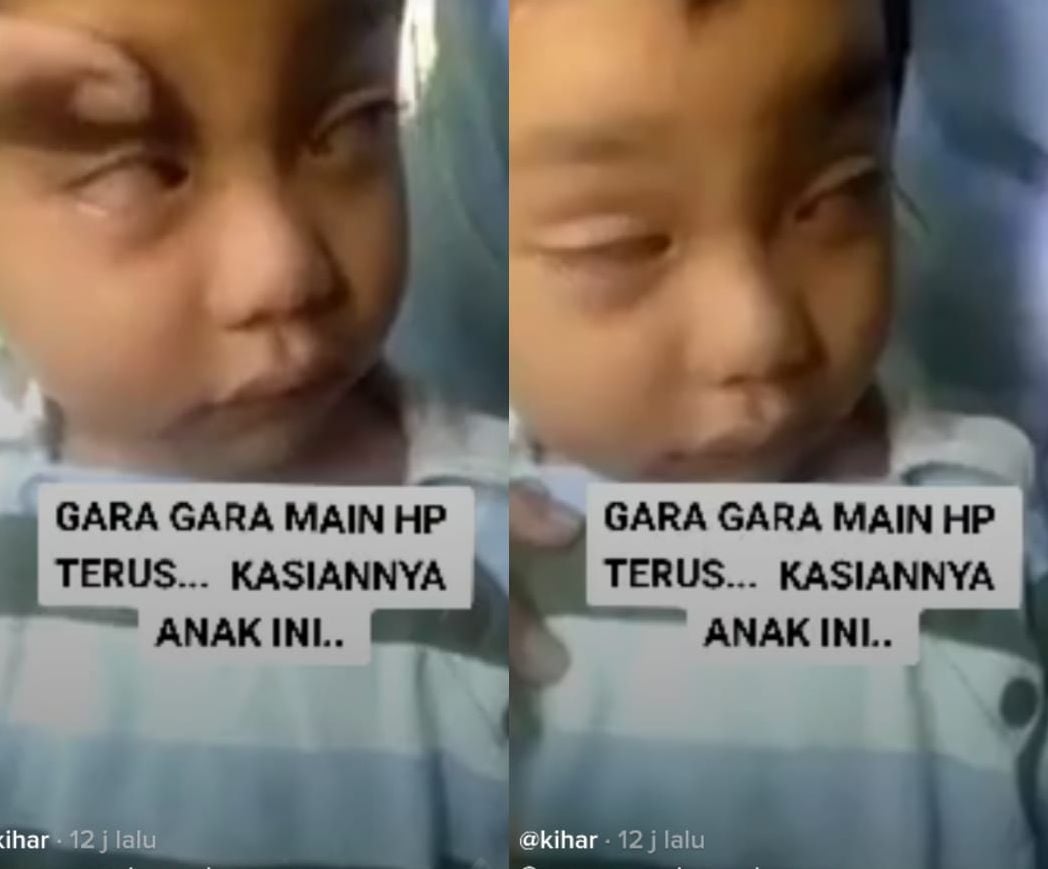 Akibat Sering Bermain Hp Bola Mata Anak Ini Alami Gangguan Hingga Selalu Melirik Keatas Editornews