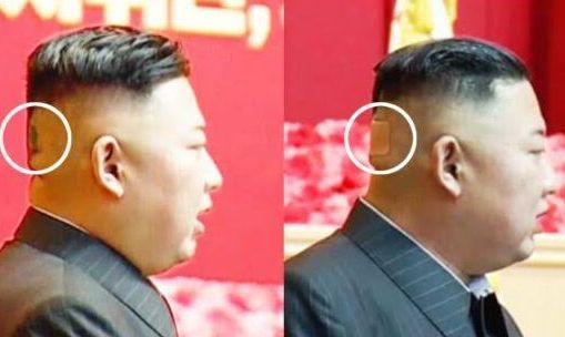 ilustrasi Kim Jong Un Terlihat Gunakan Plester di Kepala, Curi Perhatian Publik Hingga Isu Kesehatan Memburuk