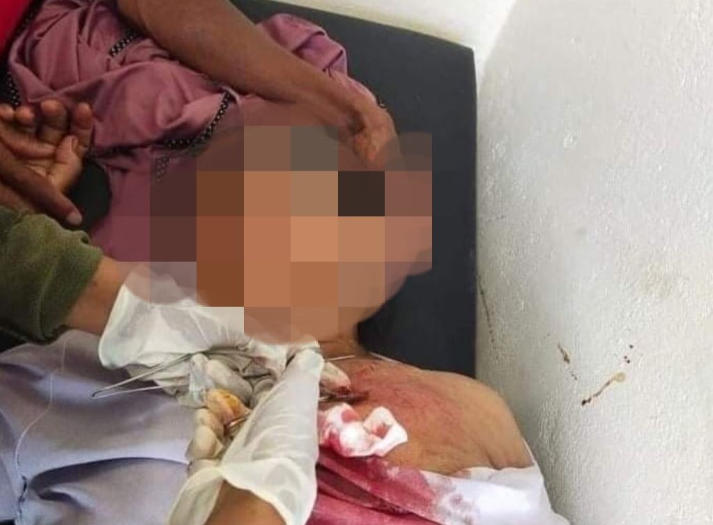 Seorang nenek lanjut usia berusia 60 tahun menjalani perawatan medis di Puskesmas Tamilouw, Kecamatan Amahai, Maluku Tengah. Perempuan sepuh itu diduga terkena peluru aparat saat konflik warga Tamilouw vs polisi pada Selasa pagi, 7 Desember 2021.