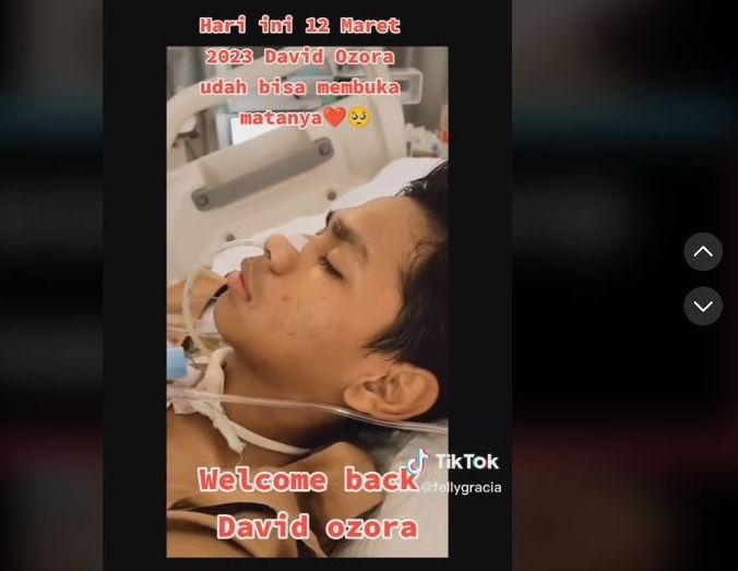 Kondisi kesehatan David Ozora korban penganiayaan Mario Danndy mulai membaik