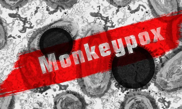 305 Cacar Monyet Terdeteksi di Inggris, Diagnosis dan Pelaporan Jadi Kunci Penghentian Penulatan