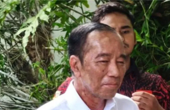 Kondisi terkini kulit wajah Jokowi