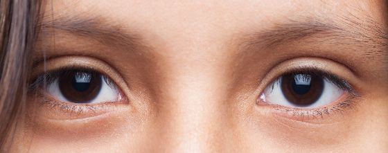 Cara menghilangkan kantung mata bisa dengan cara alami maupun medis, berikut beberapa cara yang wajib dicoba
