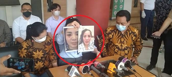 Nindy Ayunda tunjukkan bukti KDRT Askara